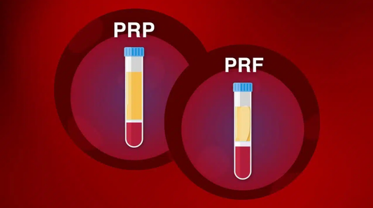 PRP vs PRF for Hair Loss: What’s the Difference – and Which Is Better?